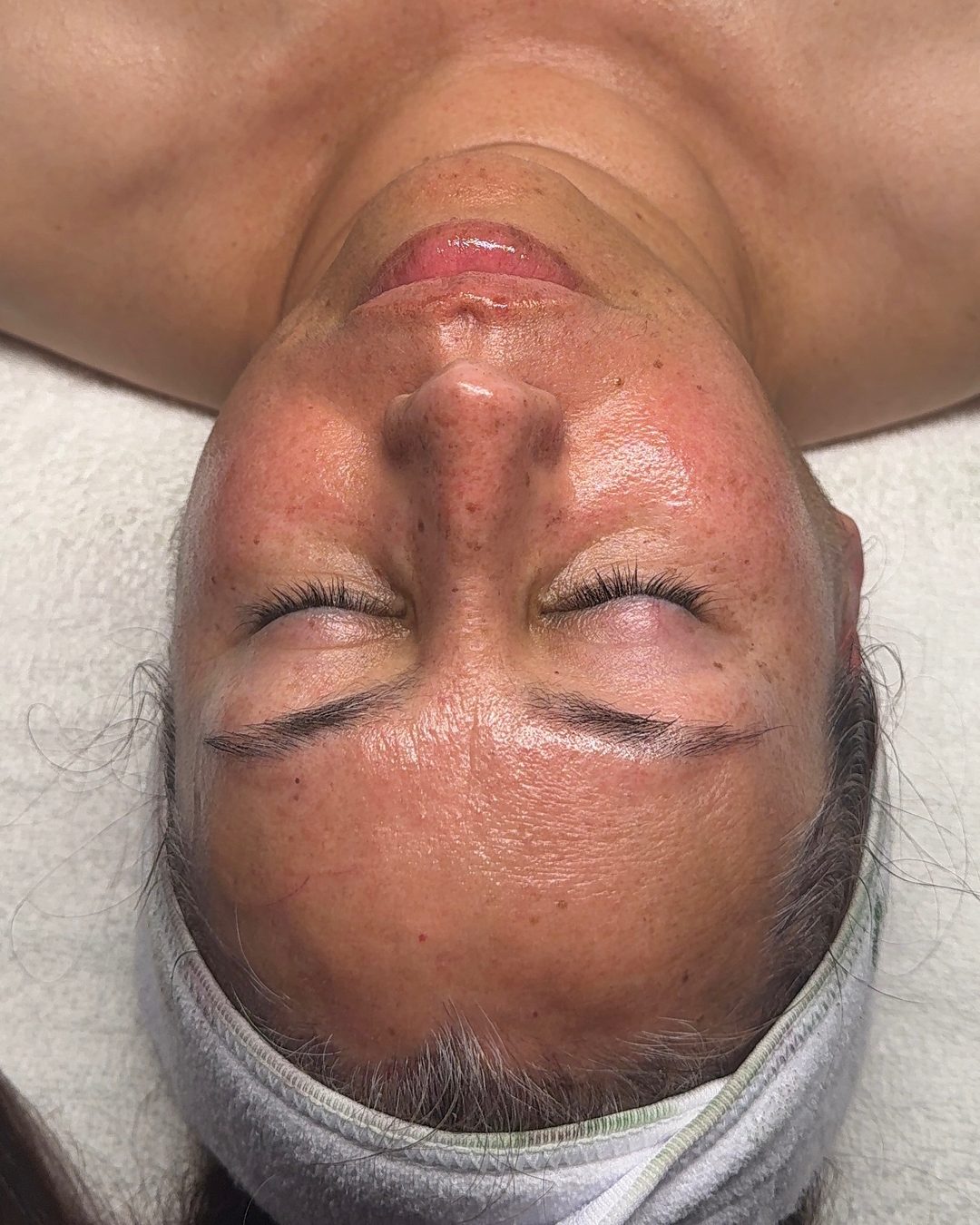 After customized facial treatment showing post-facial glow at CYNNSBEAUTY