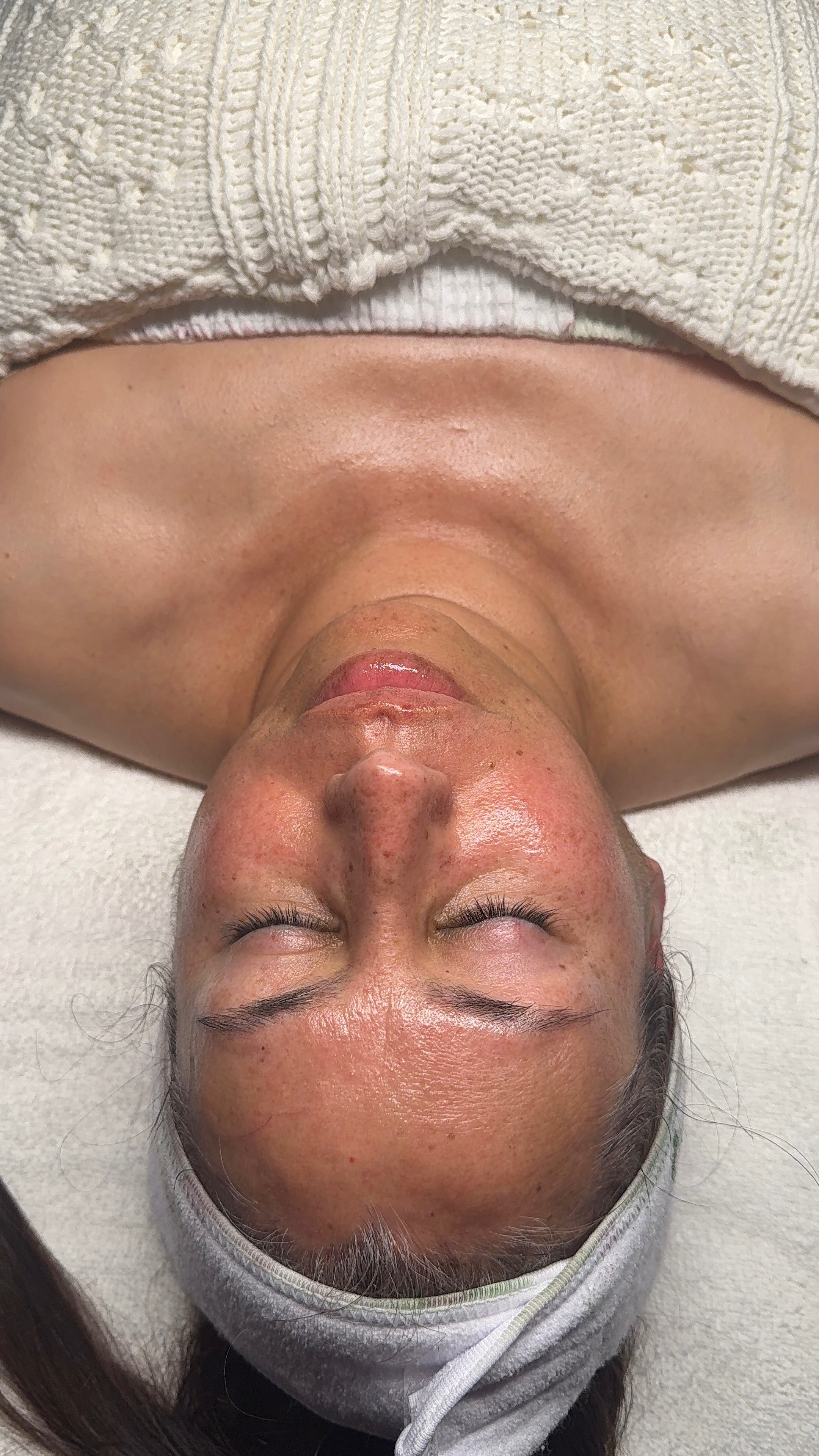 After customized facial treatment showing post-facial glow at CYNNSBEAUTY