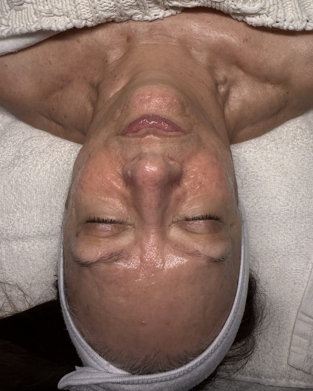 After customized facial treatment showing post-facial glow at CYNNSBEAUTY
